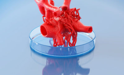 3D printing in the medical industry