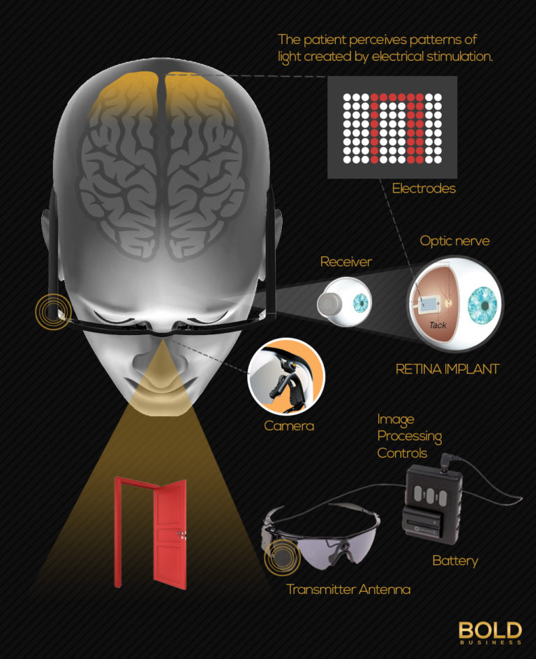 Is the Bionic Eye for Real? Bold Business