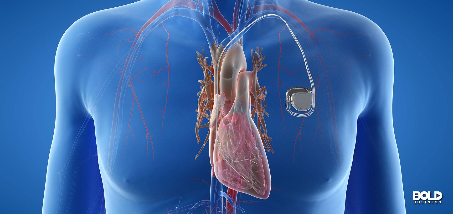 A blue person with a pacemaker
