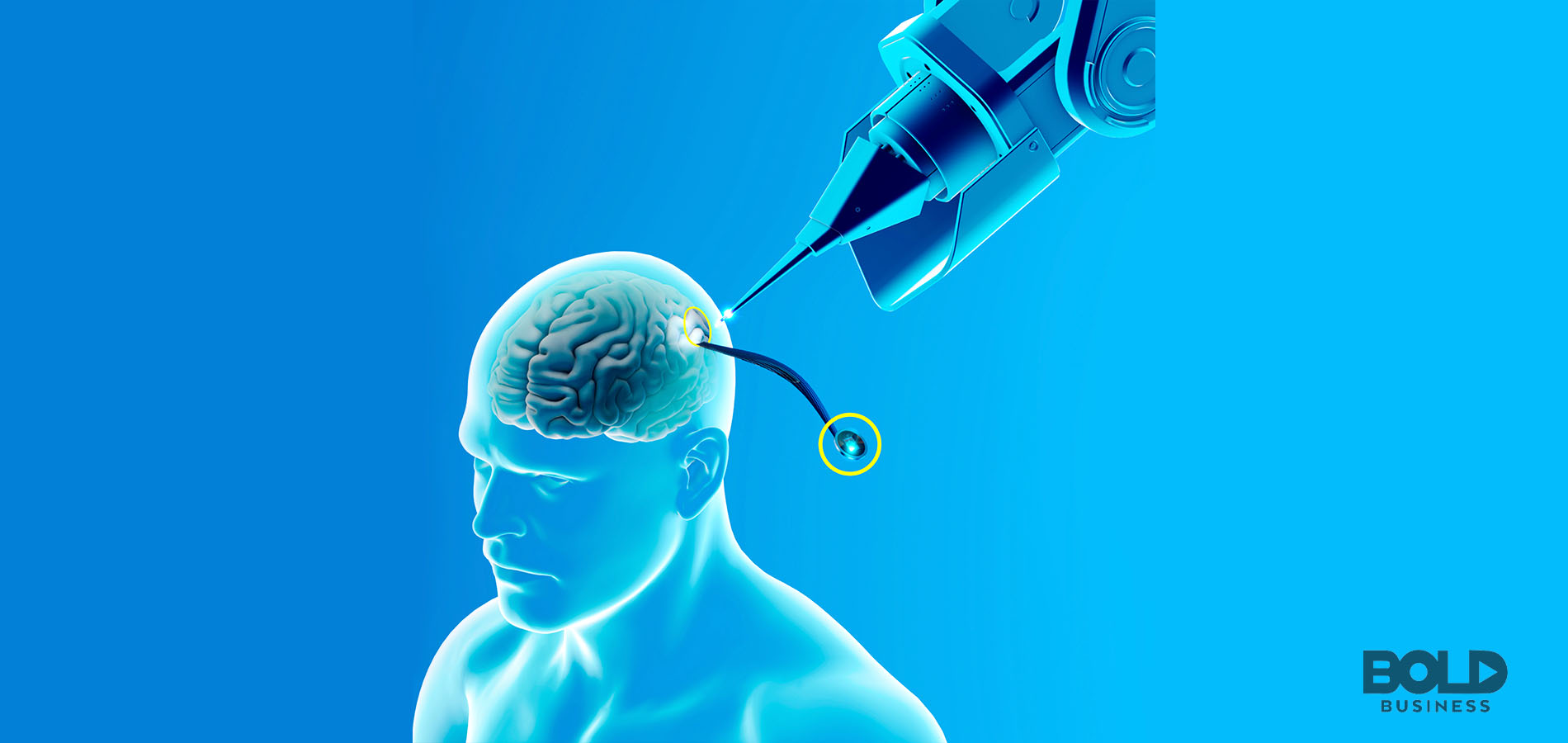A rendering of the Neuralink trials